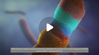 ALK-positive NSCLC: Mechanism of Disease and Resistance
